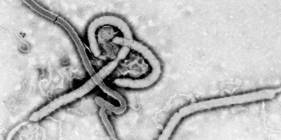 Ebola Virus