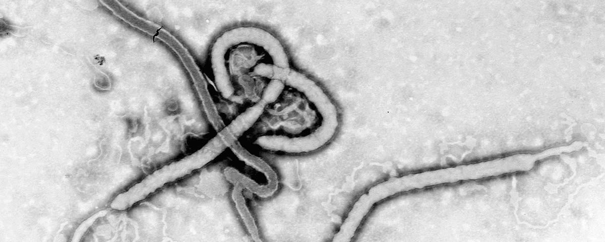 Ebola Virus