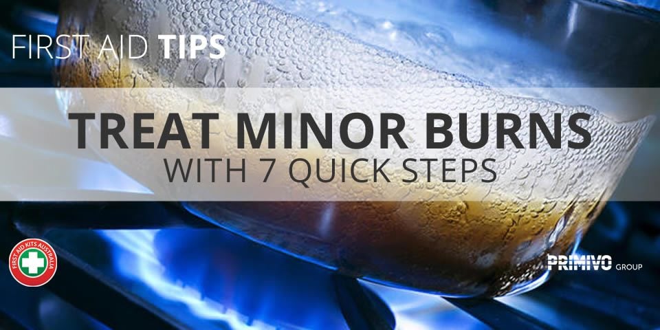 First Aid Tips Treat a Minor Burn with 7 Quick Steps