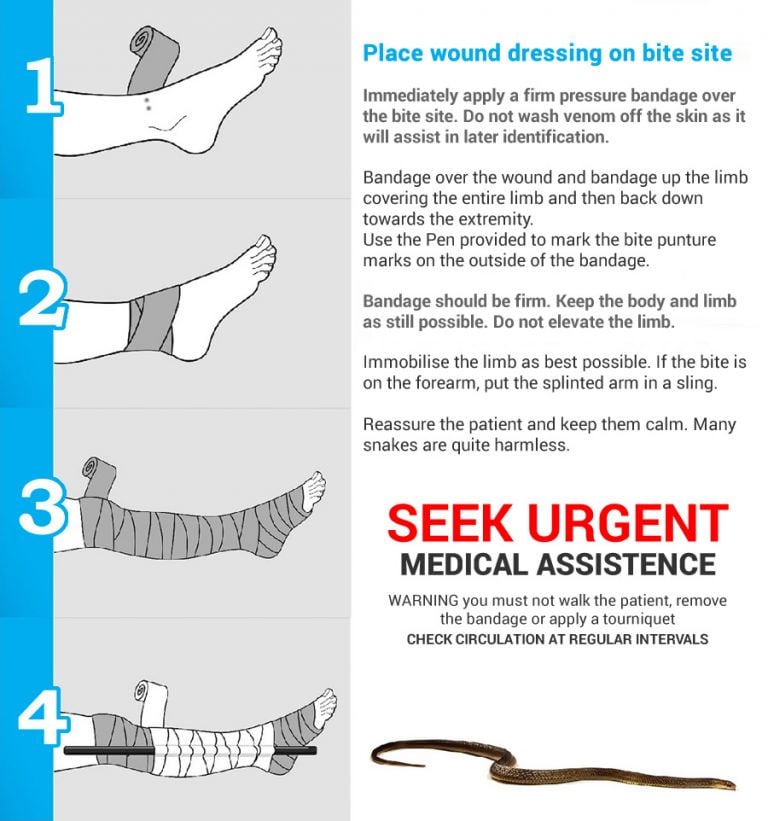 Snake bite treatment in 4 quick steps - The First Aid Kits Australia ...