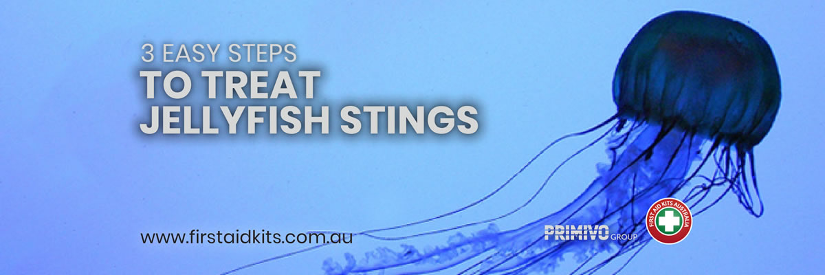 3 Easy Steps to treat Jellyfish Stings