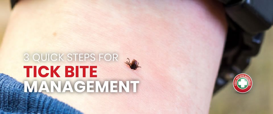 3 Quick Steps for Tick Bite Management