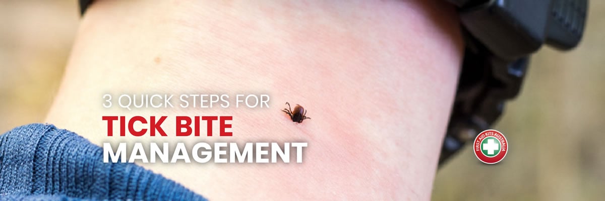 3 Quick Steps for Tick Bite Management