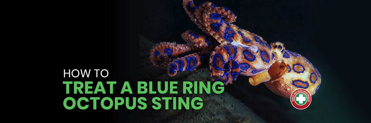 Reductor Rechtdoor kleuring The deadly pacifist: How to treat a blue ring octopus sting - The First Aid  Kits Australia Newsroom