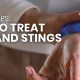 First Aid Tips: How to Treat Bites and Stings