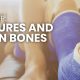 First Aid Tip: Fractures and Broken Bones
