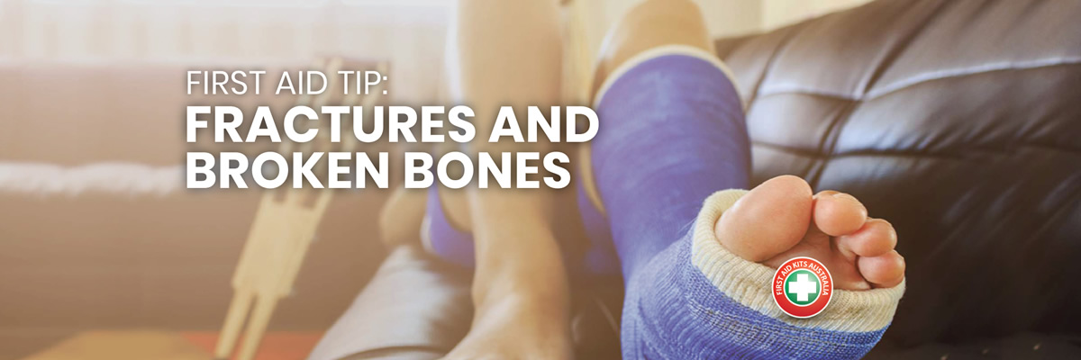 First Aid Tip: Fractures and Broken Bones