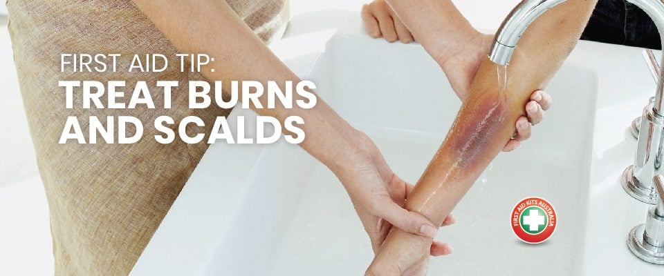 First Aid Tip: Treat Burns and Scalds