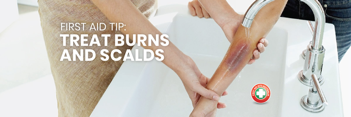 First Aid Tip: Treat Burns and Scalds