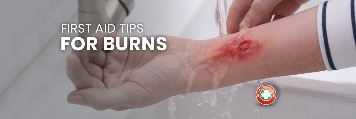 First Aid Tips For Burns