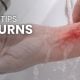 First Aid Tips For Burns